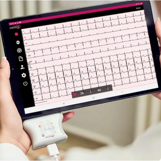 CardioNS - medyczne spoczynkowe 12-kanałowe urządzenie EKG