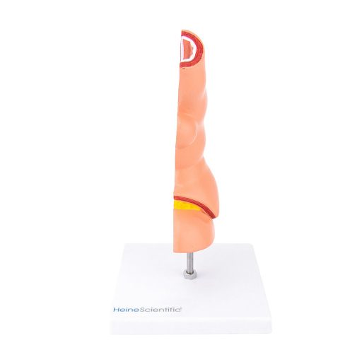 Nyelőcső modell betegségekkel