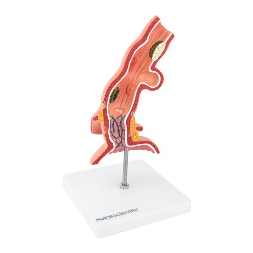 Nyelőcső modell betegségekkel