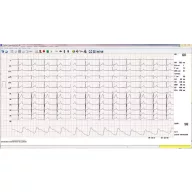 Bicycle load system with Cardiax ECG