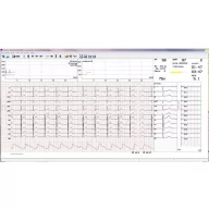 Bicycle load system with Cardiax ECG