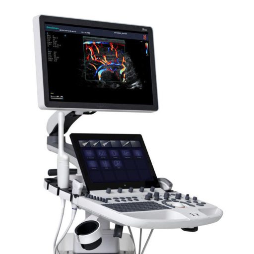SonoScape P40 Elite ultrasound device