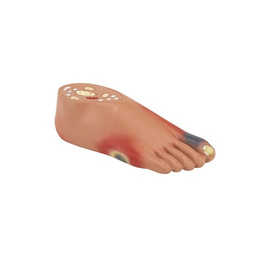 Model cukrzycy z chorobami wtórnymi