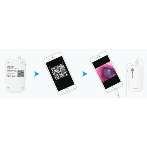 Digital Otoscope and Ear Wax Removal NTE100i (IUVC)