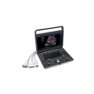SonoScape E3 portable ultrasound