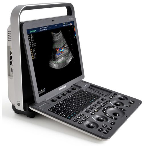 SonoScape E3 portable ultrasound